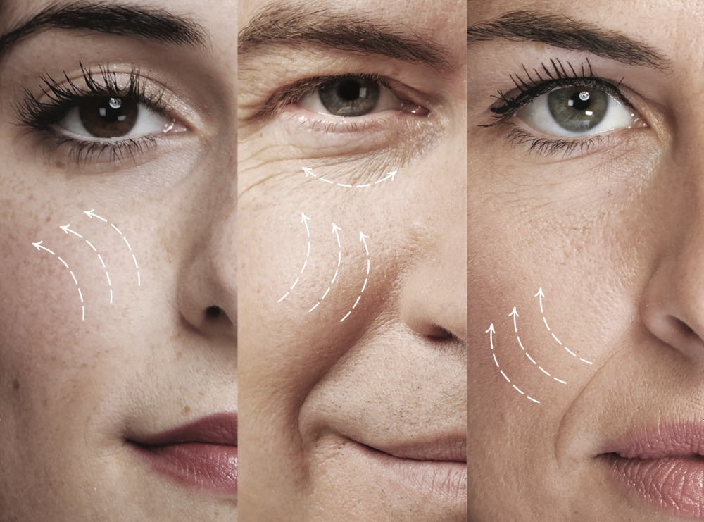 EndoDefine results on face