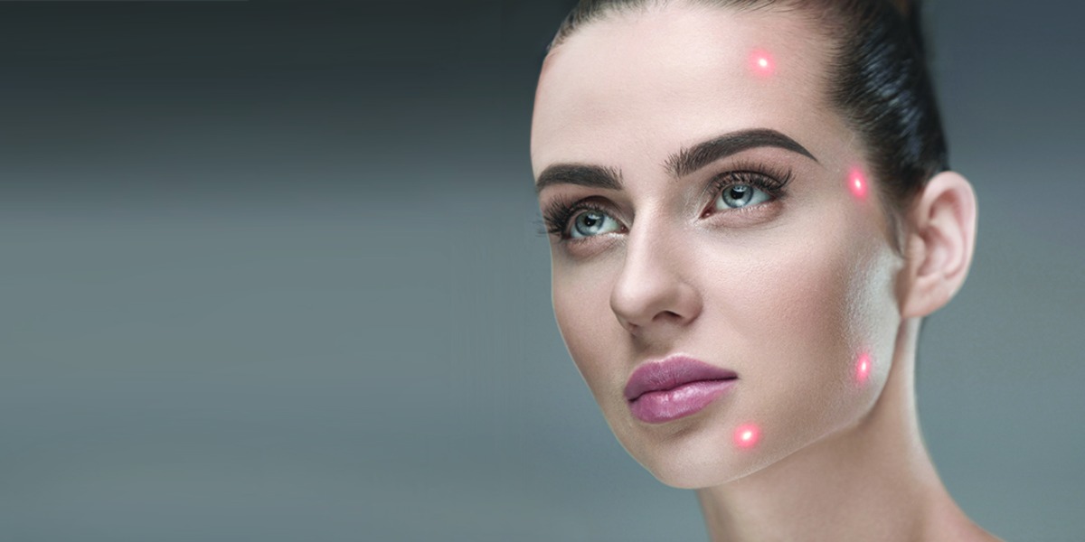 endolift (1) EndoDefine facelift